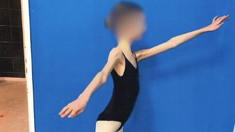 অস্ট্রেলিয়ায় মেয়েকে চিরকাল ‘বাচ্চা’ রাখতে অনাহারে রাখে বাবা-মা