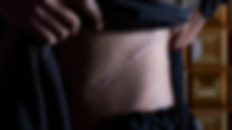 মিয়ানমারের গ্রামবাসীদের বর্ণনা: বাধ্য হয়ে অবৈধভাবে ভারতে গিয়ে বিক্রি করছে কিডনি