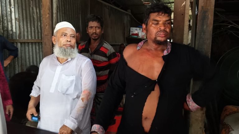 টঙ্গিবাড়ীতে জমি মাপাকে কেন্দ্র করে মারধর আহত ৬