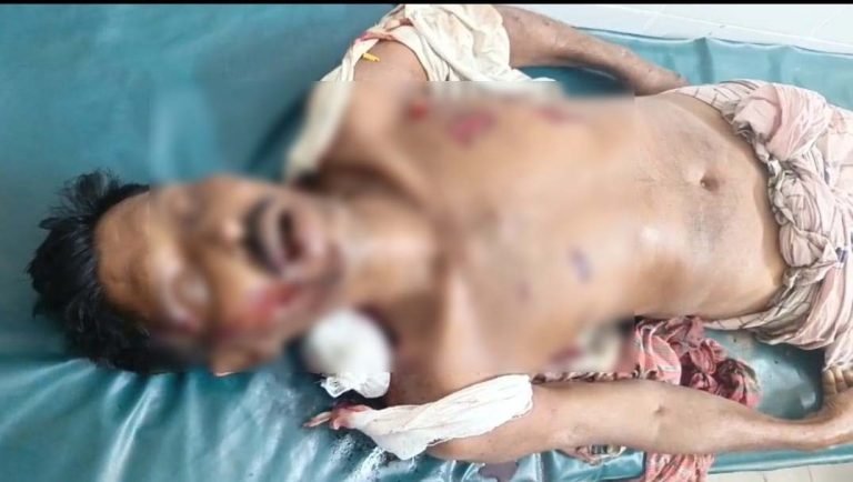 বেনাপোলে ঈদের নামাজ নিয়ে বিতর্কে বোমা হামলা বিএনপি সদস্য নিহত, আহত-১