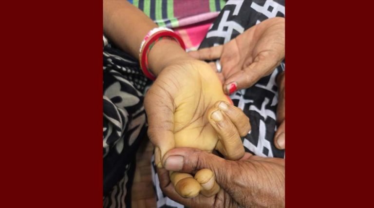 টঙ্গীবাড়ীতে সাপের কামড়ে নারীর মৃত্যু