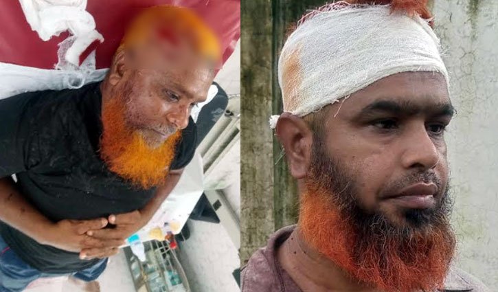 ধামরাইয়ে জমি নিয়ে বিরোধে ২ ভাইকে কুপিয়ে জখম