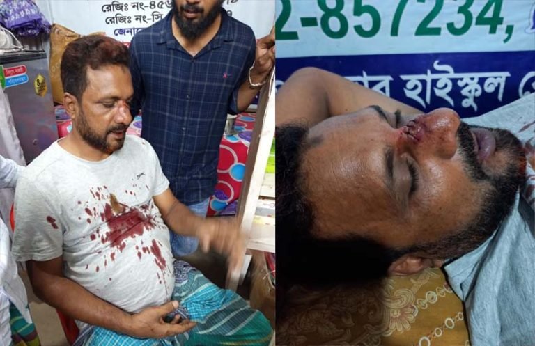 টঙ্গীবাড়িতে পূর্ব বিরোধের জেরে বিএনপি নেতাকে মারধর