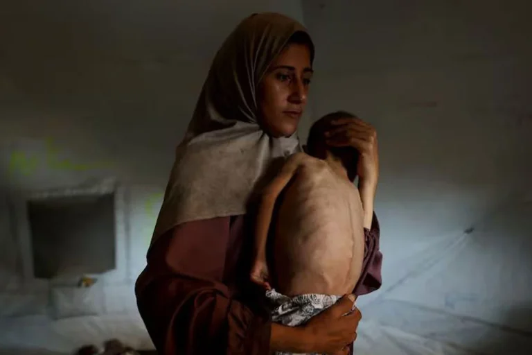 গাজায় অনাহারে মৃতের সংখ্যা দুইশ’ ছাড়াল