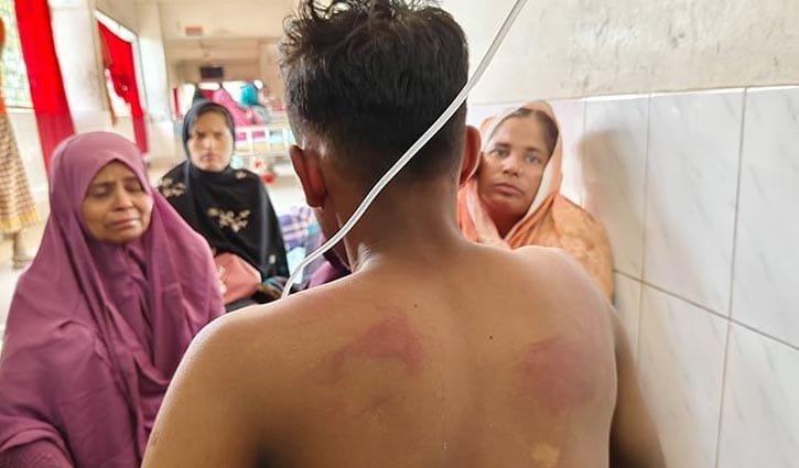 কুষ্টিয়ায় চুরির সন্দেহে ২ কিশোরকে তুলে নিয়ে রাতভর নির্যাতন