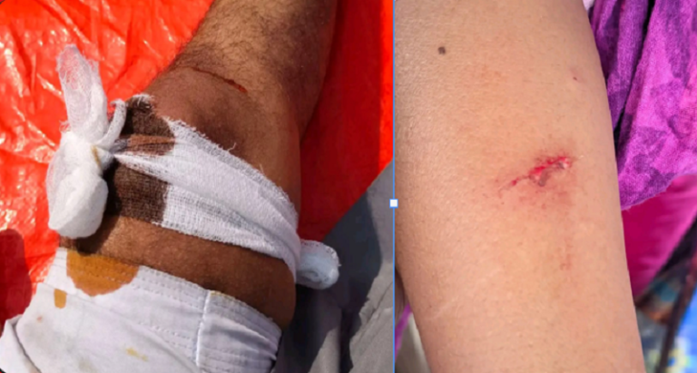 ইসলামী আন্দোলন নেতাকর্মীদের ওপর জামায়াত সমর্থকদের হামলার অভিযোগ