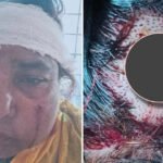 ফুলবাড়িয়ায় পূর্ব বিরোধ ও নির্বাচনী দ্বন্দ্বে বৃদ্ধার ওপর হামলা, ৭ জনের বিরুদ্ধে মামলা