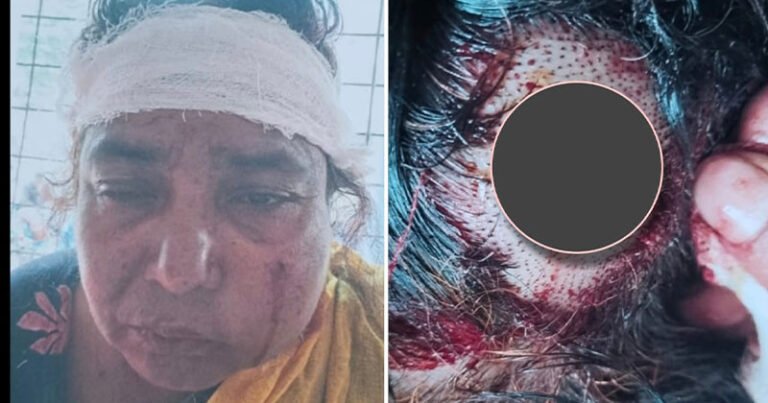 ফুলবাড়িয়ায় পূর্ব বিরোধ ও নির্বাচনী দ্বন্দ্বে বৃদ্ধার ওপর হামলা, ৭ জনের বিরুদ্ধে মামলা