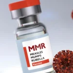 ঢাকাসহ ৪ সিটিতে হামের টিকা দেওয়া হবে আজ