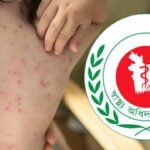 হাম ও হামের উপসর্গ নিয়ে আরও ৭ শিশুর মৃত্যু