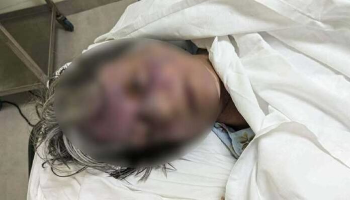 গুলশানে বিদেশি নাগরিককে পিটিয়ে হত্যার অভিযোগ