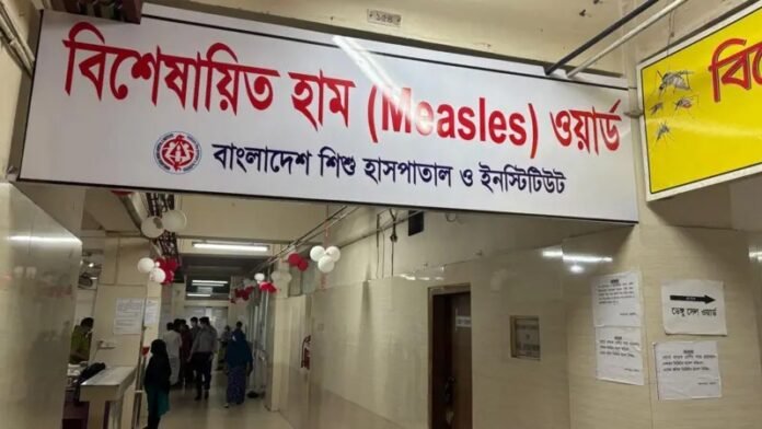 ২৪ ঘণ্টায় হামের উপসর্গে আরও ৬ শিশুর মৃত্যু