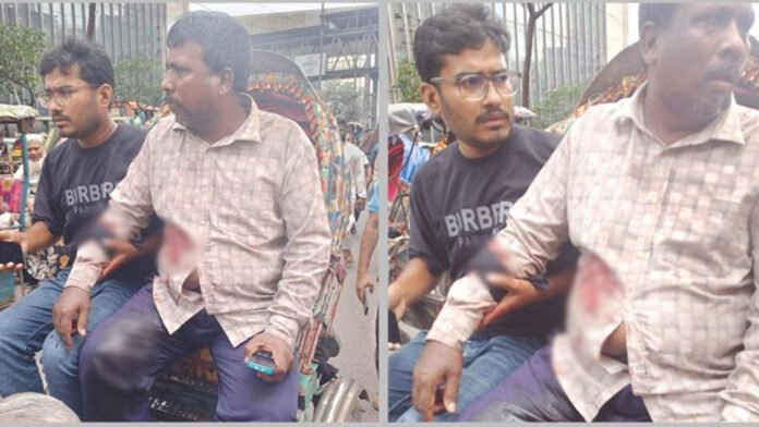 প্রকাশ্যে ব্যবসায়ীকে গুলি করে ১৭ হাজার ডলার ছিনতাই