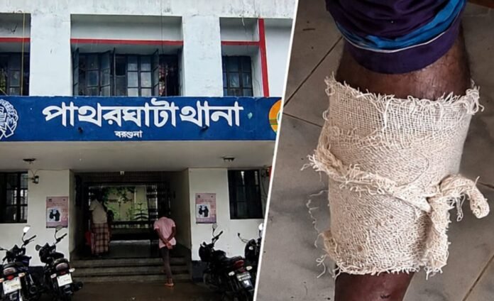 পাথরঘাটায় জমি সংক্রান্ত দ্বন্দ্বে যুবককে কোপানোর অভিযোগ, আহত ৪