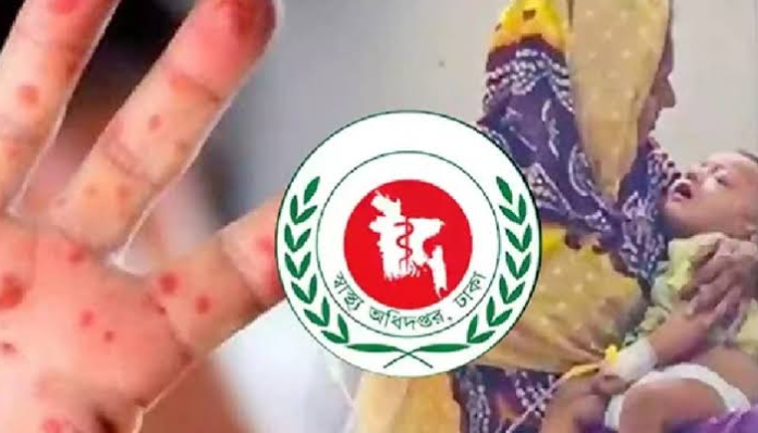 হামের উপসর্গে আরও এক শিশুর মৃত্যু, মোট প্রাণহানি ৭৮০