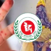 ২৪ ঘণ্টায় হাম উপসর্গে দুইজনের মৃত্যু, নতুন আক্রান্ত ১০৮৫